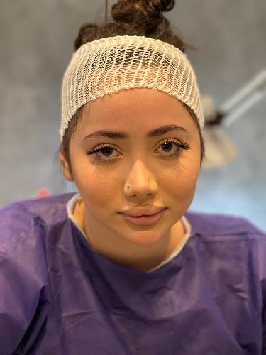 کاشت موی تخصصی ایمانی در تبریز