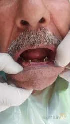 نمونه کار دندانپزشکی دکترمحمدرضا پرورش  در تبریز - 7