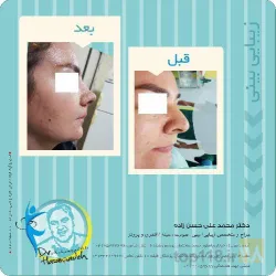 نمونه کار مطب پزشکی زیبایی دکتر حسن زاده  در تبریز - 7