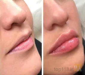 نمونه کار مطب دکتر داریوش دکترزاده  در مرند - 7