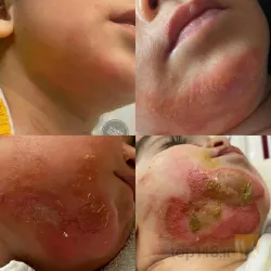 نمونه کار مرکز  زخم دکتر قادری تبریز در تبریز - 7