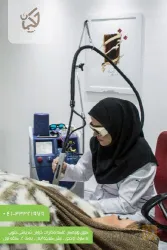 نمونه کار درمانگاه تخصصی کاشت مو و لیزر حکیمان  در تبریز - 7