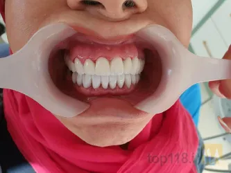 نمونه کار دندانپزشکی دکتر سعید حاجی پور  در تبریز - 7