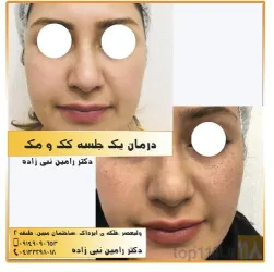 نمونه کار مطب دکتر رامین نبی زاده در تبریز - 7