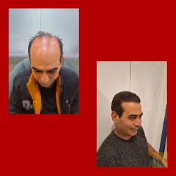 نمونه کار کلینیک تخصصی پوست و مو یاقوت در تبریز - 7