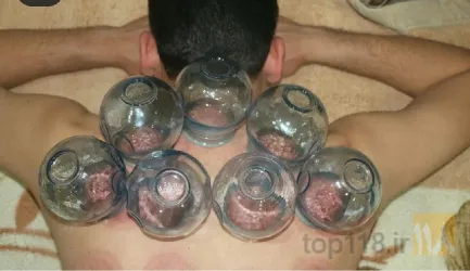 نمونه کار کایروپراکتیک و طب سنتی در تبریز - 6