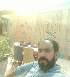 نمونه کار بهترین کاشت مو در تبریز  کاشت موی فرمانی در تبریز - 7