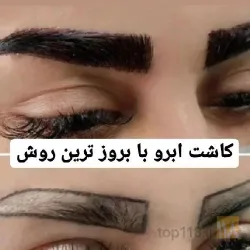 نمونه کار کاشت مو تخصصی در تبریز - 7