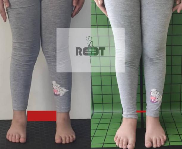 مرکز تندرستی و حرکات اصلاحی ریست در تبریز اصلاح ناهنجاریهای جسمانی و ریکاوری در تبریز