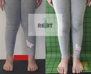 نمونه کار مرکز تندرستی و حرکات اصلاحی ریست در تبریز - 8