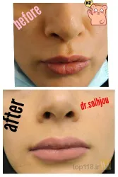 نمونه کار مطب پوست و مو دکتر صلح جو در تبریز - 8