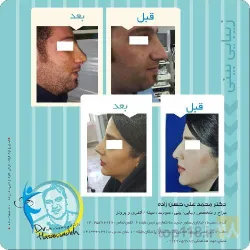 نمونه کار مطب پزشکی زیبایی دکتر حسن زاده  در تبریز - 8