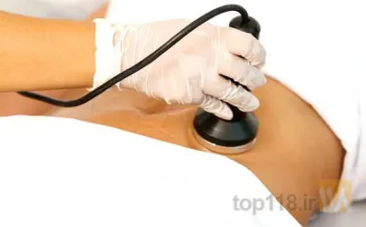 نمونه کار لاغری و تناسب اندام رادپور در تبریز - 8