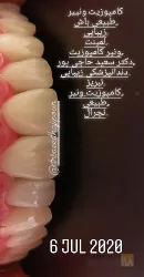 نمونه کار دندانپزشکی دکتر سعید حاجی پور  در تبریز - 8