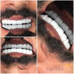 نمونه کار دندانپزشکی  دکتر سید  ابراهیم تقوی در تبریز - 8