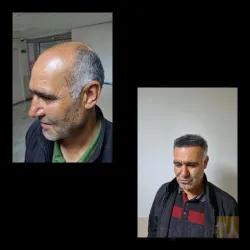 نمونه کار کلینیک تخصصی پوست و مو یاقوت در تبریز - 8