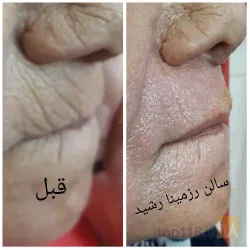 نمونه کار سالن زیبایی رزمینا رشید در تبریز - 8