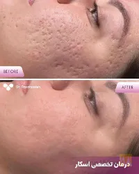 نمونه کار پوست مو و زیبایی لیزر دکتر مریم پناهزاده در تبریز - 7