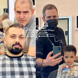 نمونه کار کلینیک تخصصی کاشت موی رحیمی در تبریز - 7
